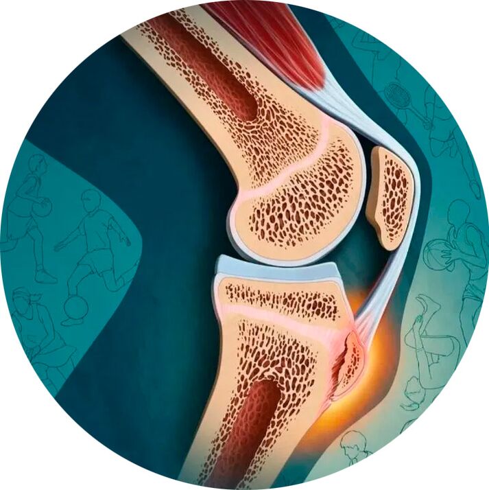 La structure de l'articulation et des tissus environnants