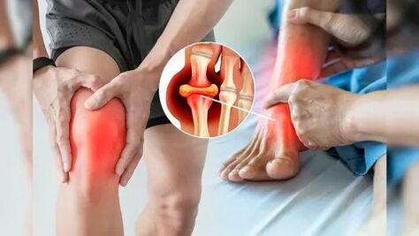 Zones cutanées adaptées à l'application du gel Icexin (genoux, coudes, bas du dos)