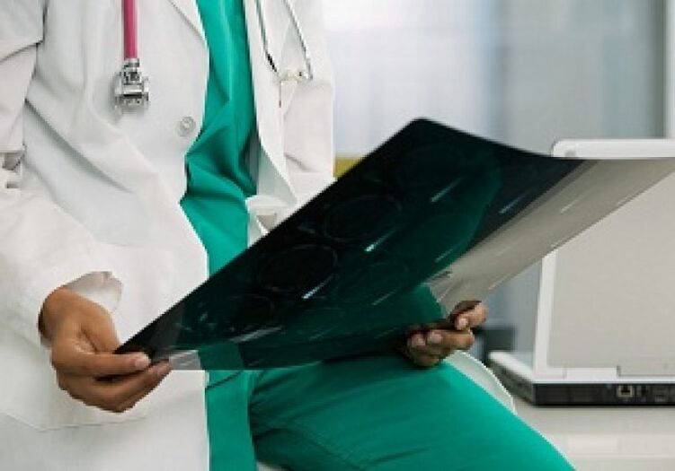 La radiographie aidera le médecin à diagnostiquer l'ostéochondrose de la colonne thoracique